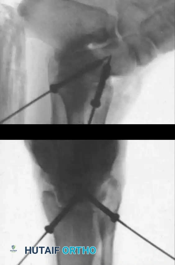 Hutaifortho's Orthopaedic Diagram