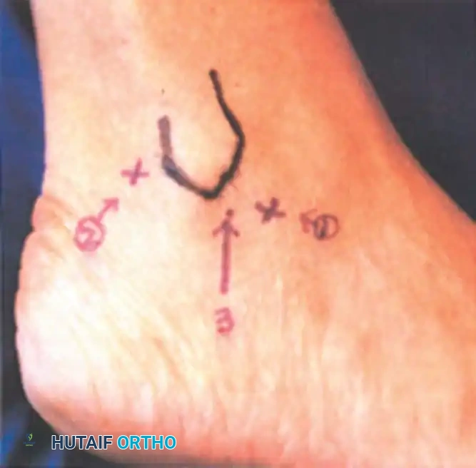 Hutaifortho's Orthopaedic Diagram