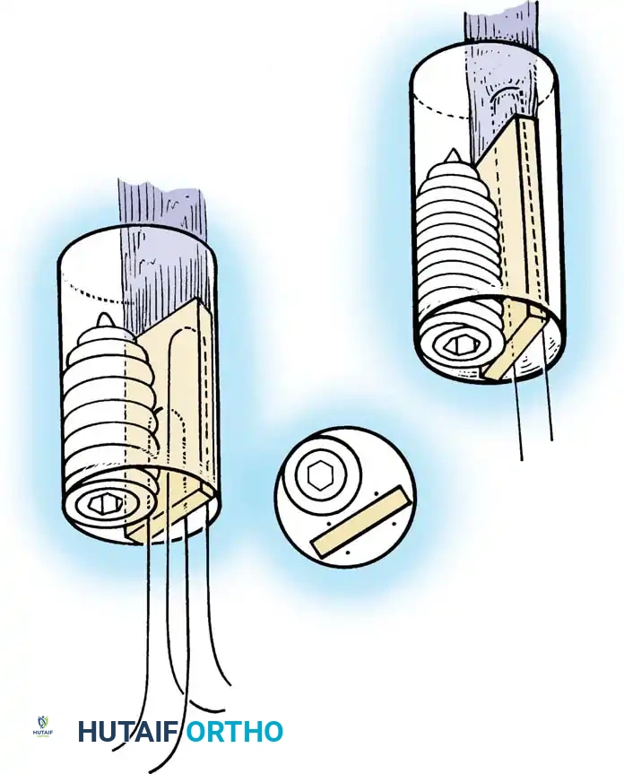Hutaifortho's Orthopaedic Diagram