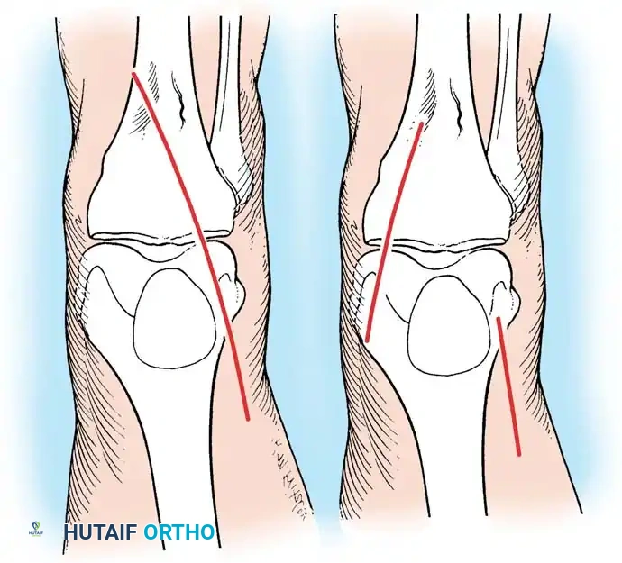 Hutaifortho's Orthopaedic Diagram