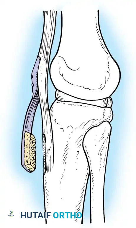 Hutaifortho's Orthopaedic Diagram