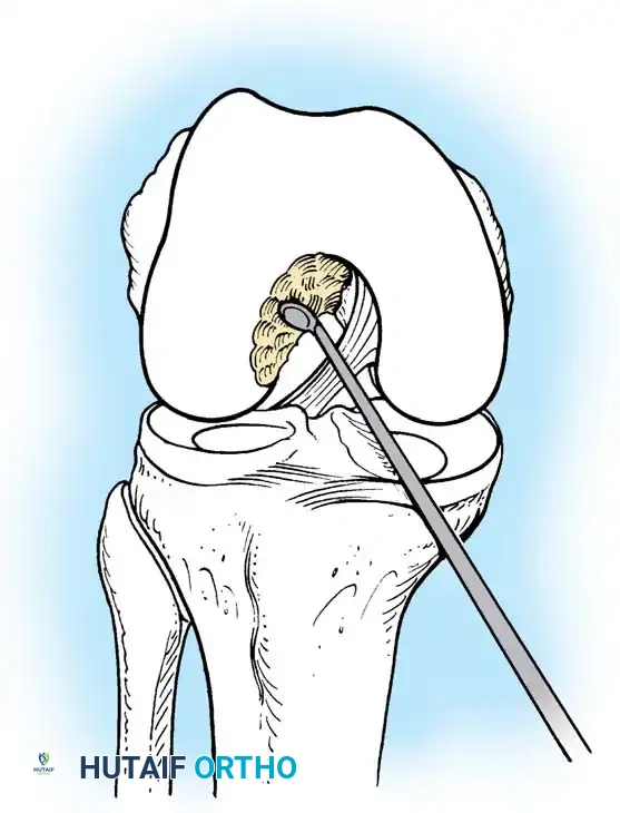 Hutaifortho's Orthopaedic Diagram