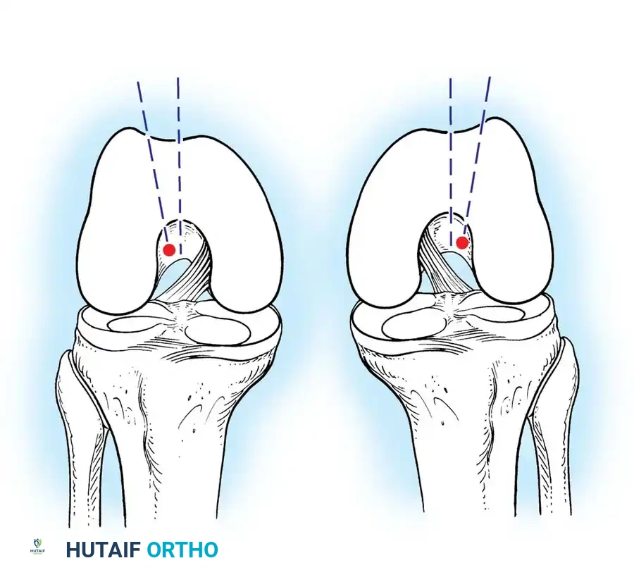 Hutaifortho's Orthopaedic Diagram