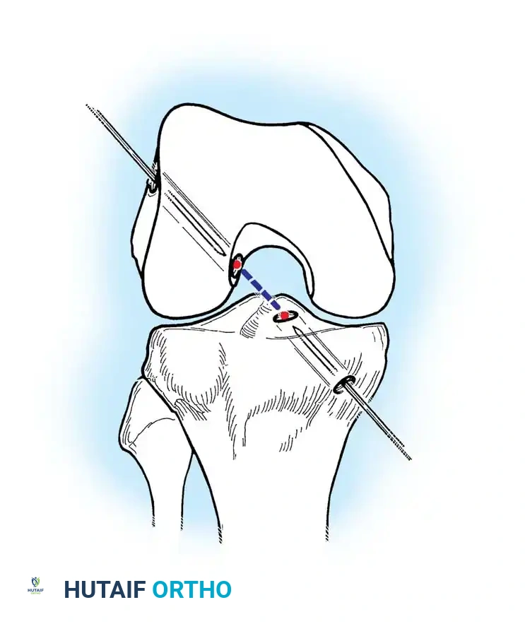Hutaifortho's Orthopaedic Diagram