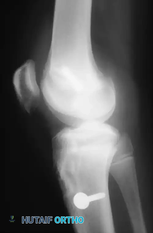 Hutaifortho's Orthopaedic Diagram