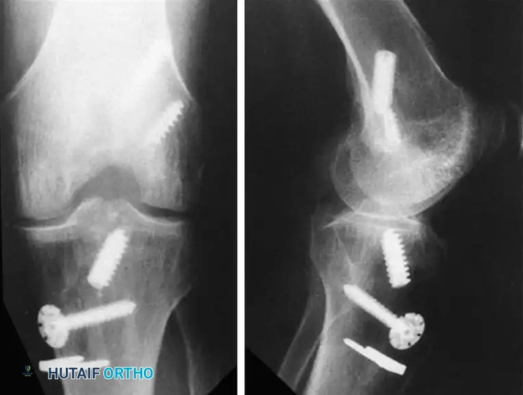 Hutaifortho's Orthopaedic Diagram