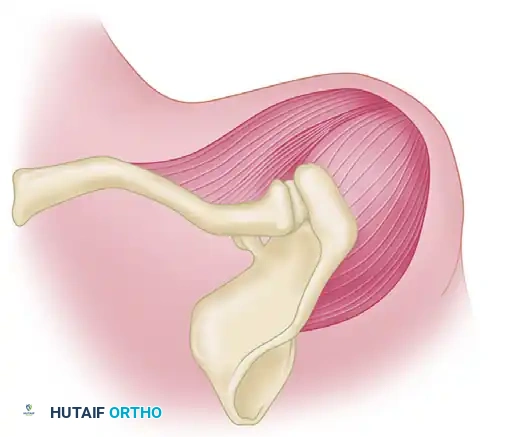 Leave bone attached to deltoid over end of acromion
