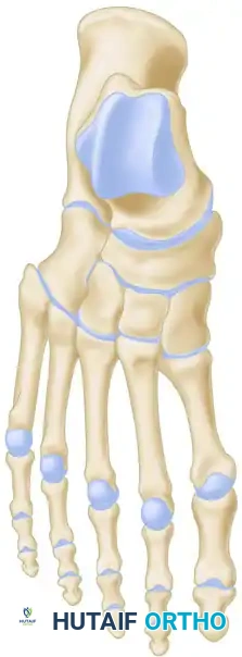 Radiographic Assessment of Cavus