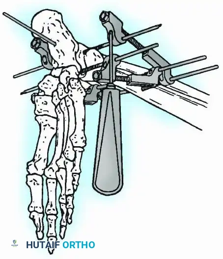 Hutaifortho's Orthopaedic Diagram