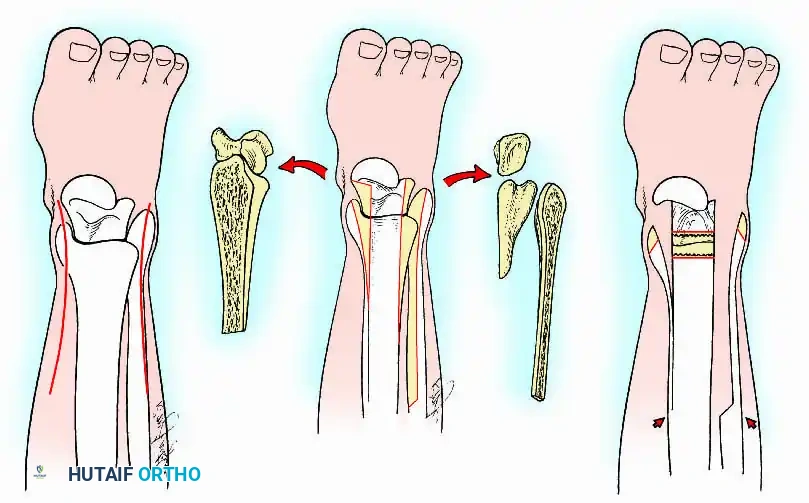 Hutaifortho's Orthopaedic Diagram