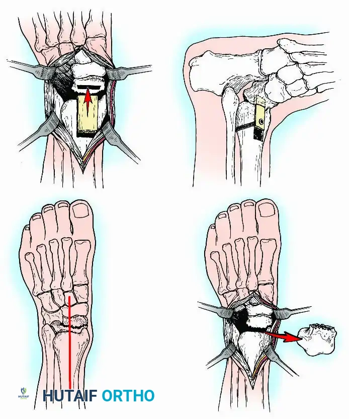 Hutaifortho's Orthopaedic Diagram