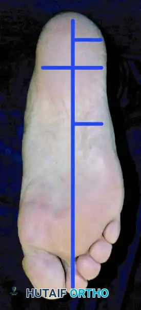 Hutaifortho's Orthopaedic Diagram