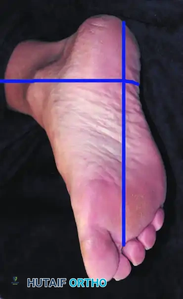 Hutaifortho's Orthopaedic Diagram