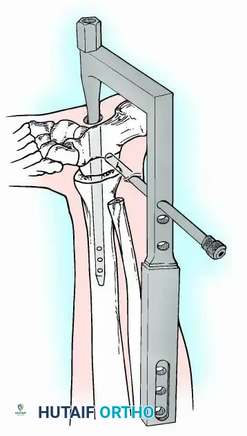 Hutaifortho's Orthopaedic Diagram