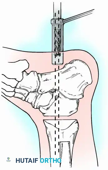 Hutaifortho's Orthopaedic Diagram