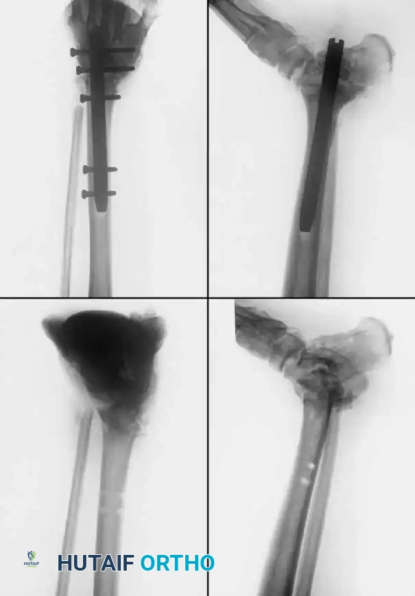 Hutaifortho's Orthopaedic Diagram