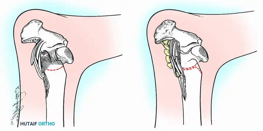 
Associated Surgical & Radiographic Imaging
![Hutaifortho's Orthopaedic Diagram