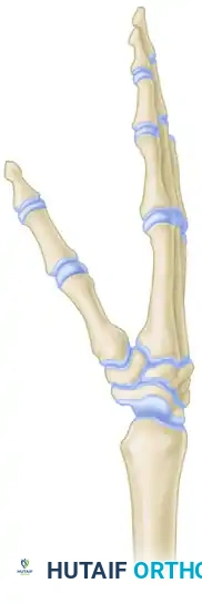 Masterclass in Wrist Arthrodesis: Haddad-Riordan and AO/ASIF Techniques