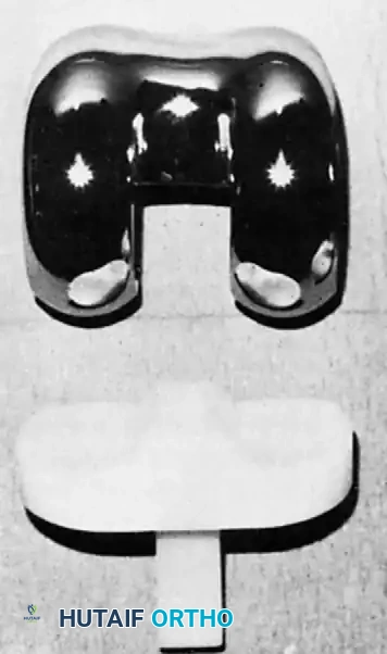 Knee Arthroplasty: Prosthesis Design, Biomechanics & Surgical Technique