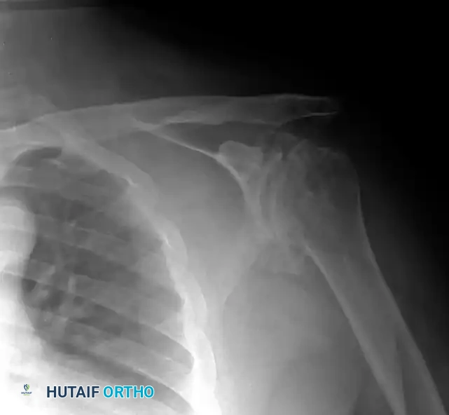 Hutaifortho's Orthopaedic Diagram