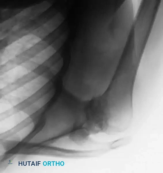 Hutaifortho's Orthopaedic Diagram