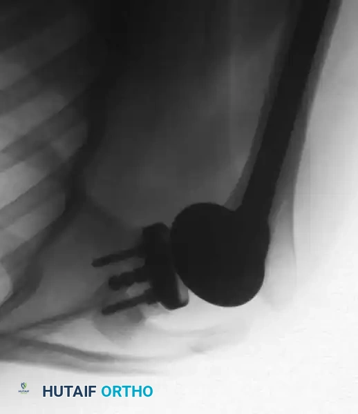 Hutaifortho's Orthopaedic Diagram