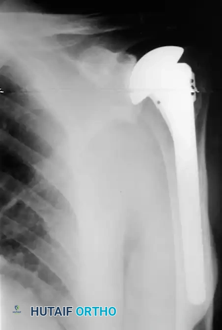 Hutaifortho's Orthopaedic Diagram