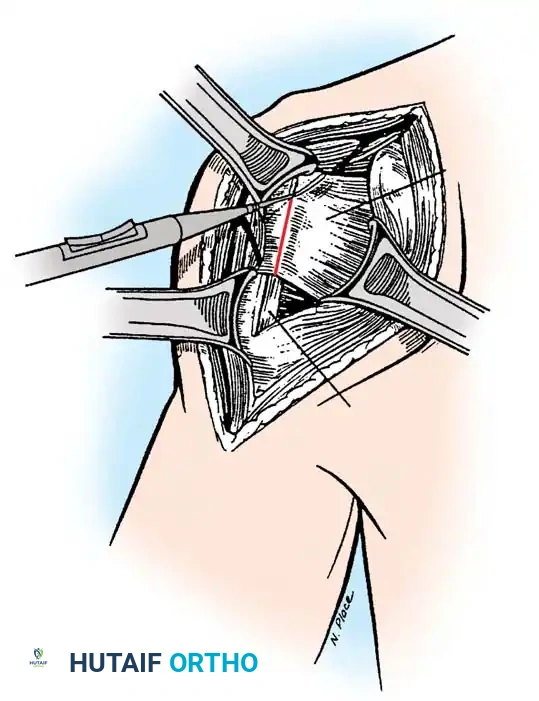 Hutaifortho's Orthopaedic Diagram