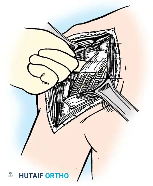 Hutaifortho's Orthopaedic Diagram