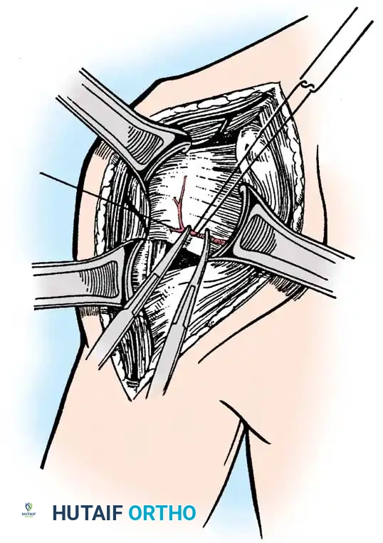 Hutaifortho's Orthopaedic Diagram
