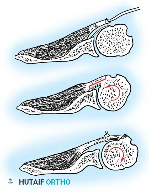 Hutaifortho's Orthopaedic Diagram