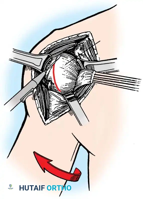 Hutaifortho's Orthopaedic Diagram