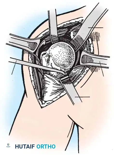 Hutaifortho's Orthopaedic Diagram