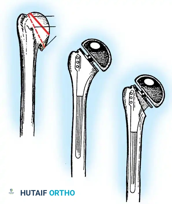 Hutaifortho's Orthopaedic Diagram