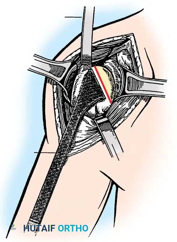 Hutaifortho's Orthopaedic Diagram