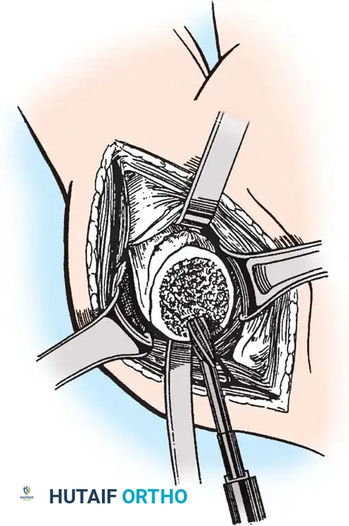 Hutaifortho's Orthopaedic Diagram