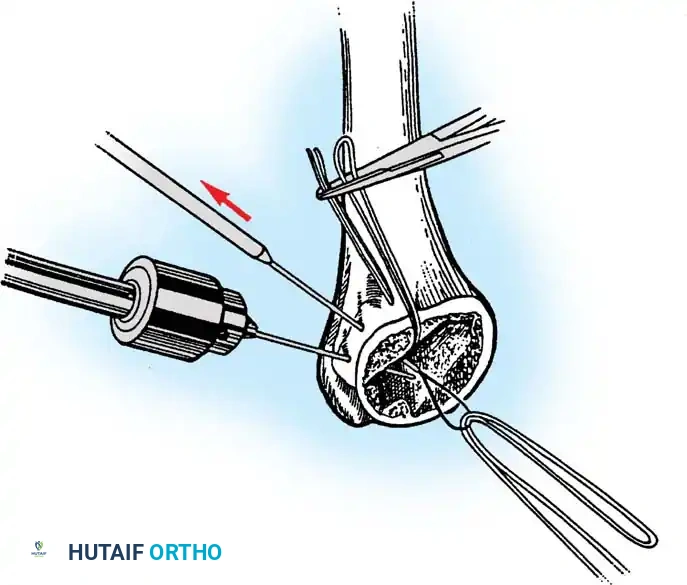Hutaifortho's Orthopaedic Diagram