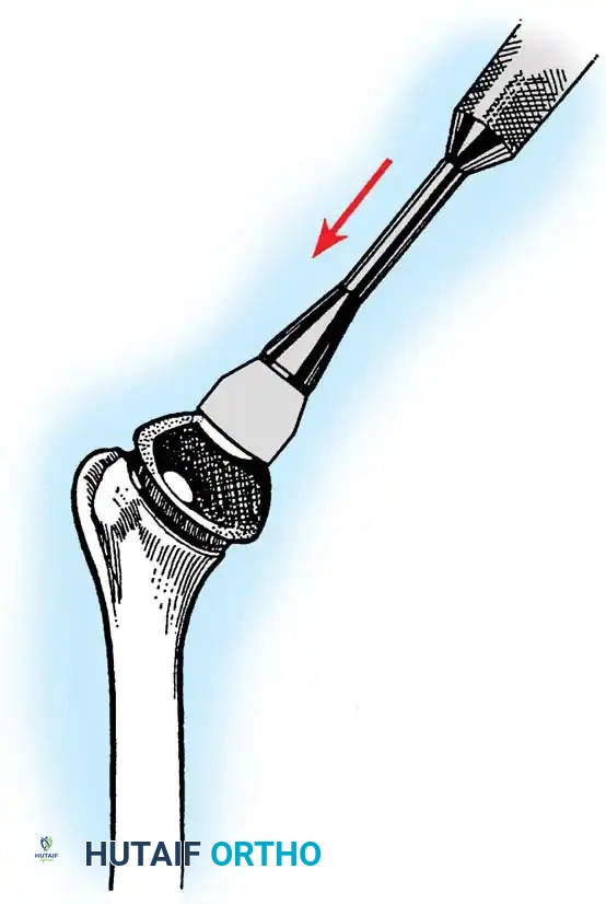 Hutaifortho's Orthopaedic Diagram