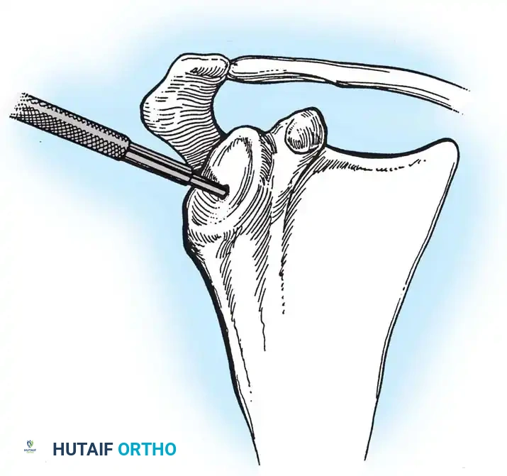 Hutaifortho's Orthopaedic Diagram