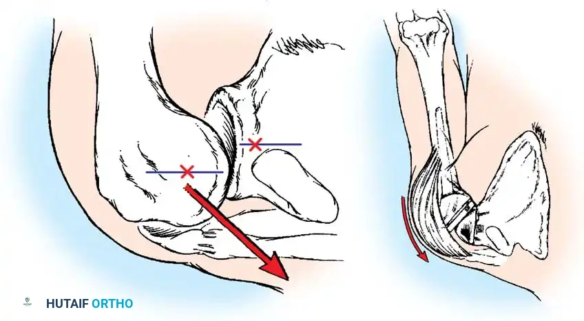 Hutaifortho's Orthopaedic Diagram