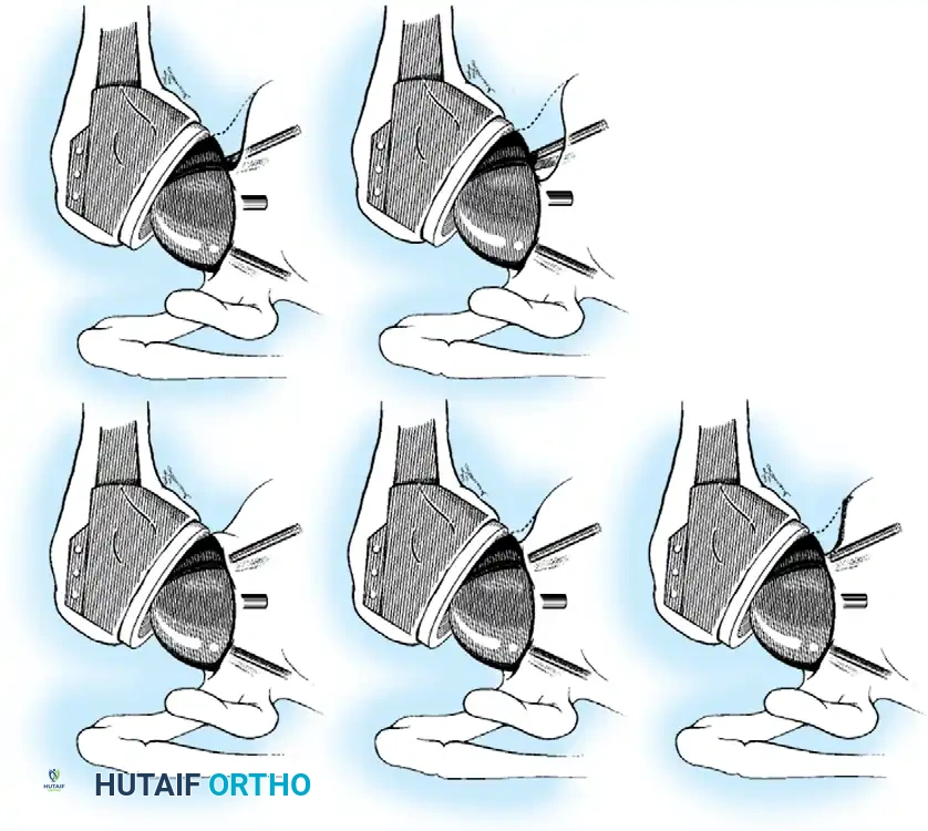 Hutaifortho's Orthopaedic Diagram