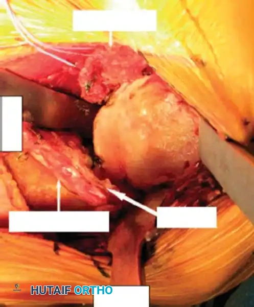 Hutaifortho's Orthopaedic Diagram