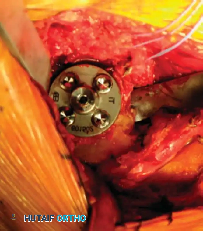 Hutaifortho's Orthopaedic Diagram