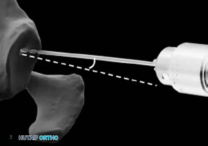 Hutaifortho's Orthopaedic Diagram