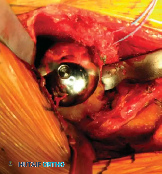 Hutaifortho's Orthopaedic Diagram