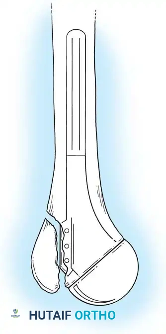 Hutaifortho's Orthopaedic Diagram