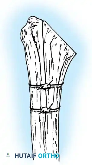 Hutaifortho's Orthopaedic Diagram