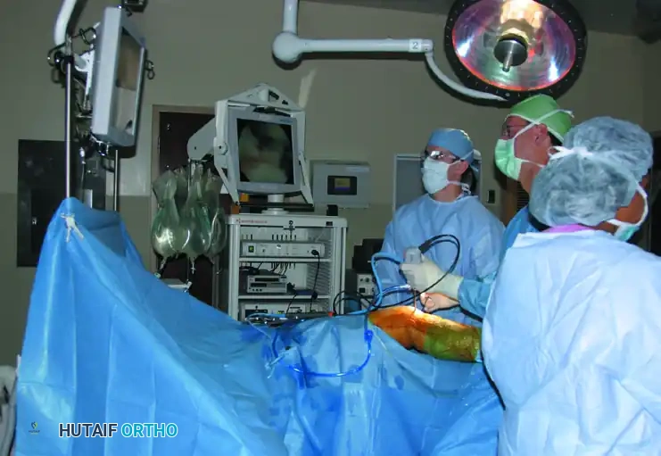 FIGURE 51-1 Waterproof outer drape with central rubberized opening seals unsterile proximal thigh from operative field.