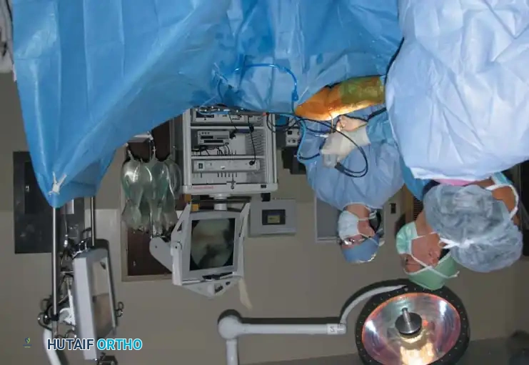 Fig. 48-3 Technique of table-fl at position. Surgeon and assistant stand at side of table.