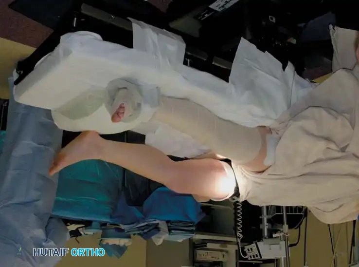 Arthroscopy of the Lower Extremity Surgical Diagram